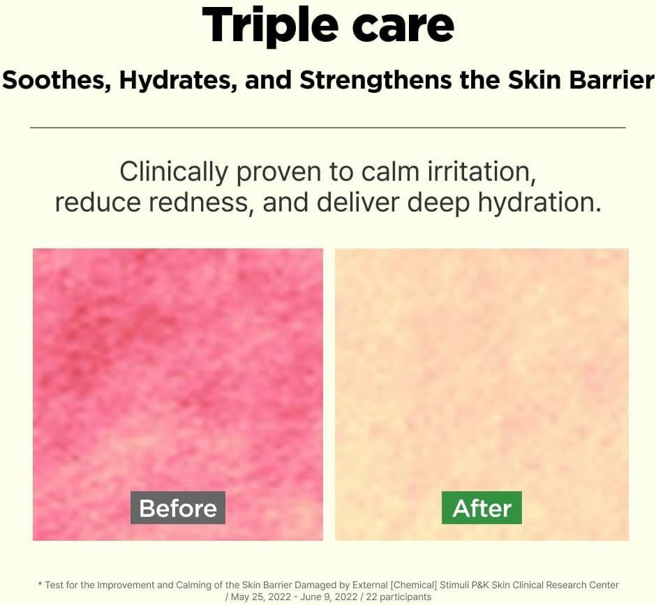 ISOI Moisture Dr. Soothing Toner, Lightweight Hydrating Toner for The Face with Tea Tree Ceramide & Hyaluronic Acid for Skin Barrier Support, Korean Skin Care (4.39 fl. oz/130ml)