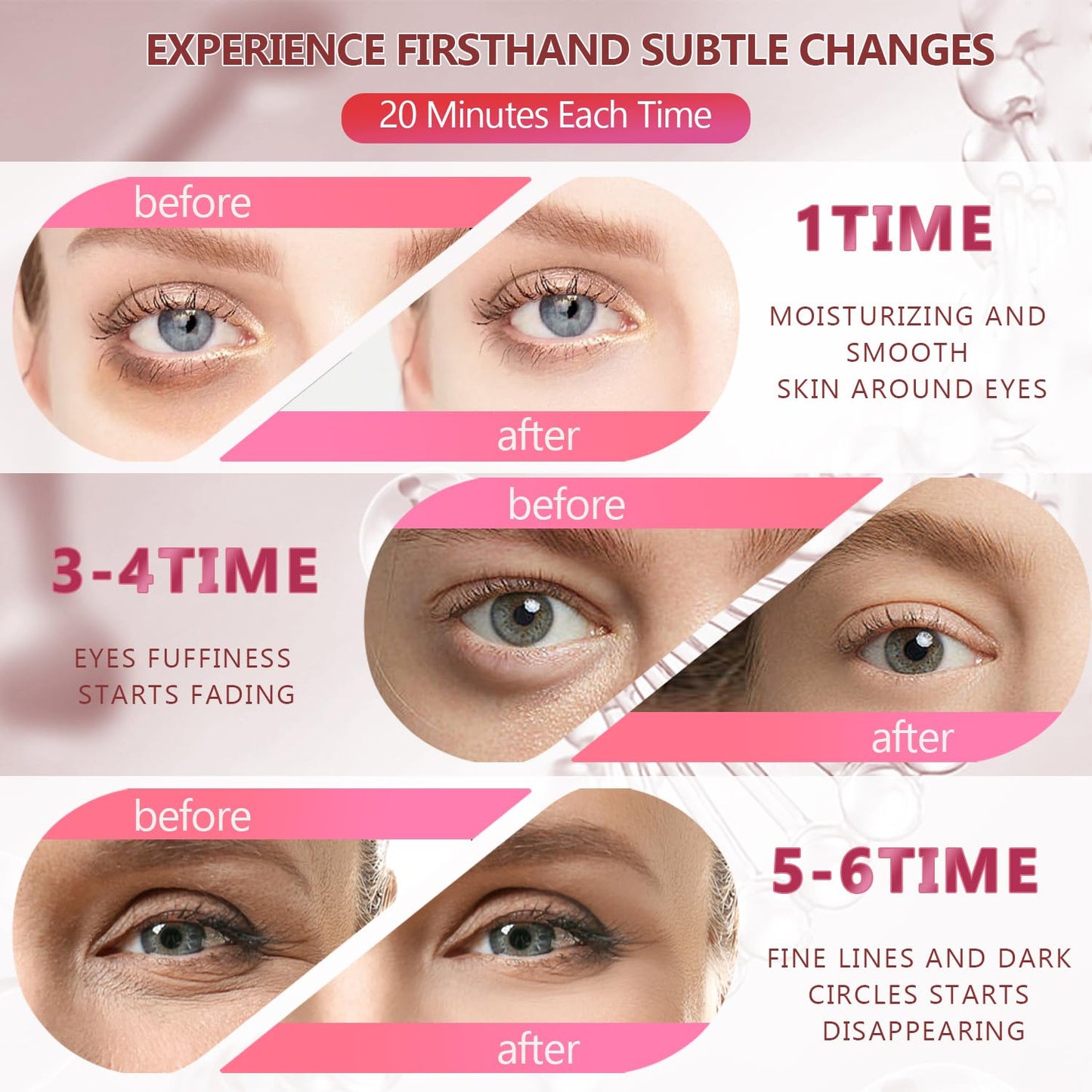 2 Packs 60 Pcs Under Eye Patches, Pink+Green, 30 Pairs Women Undereye Mask for Puffy Eyes Dark Circles Treatment, Men Collagen Gel Pads Hydrating for Eye Bags Puffiness Wrinkle, Beauty Skin Care