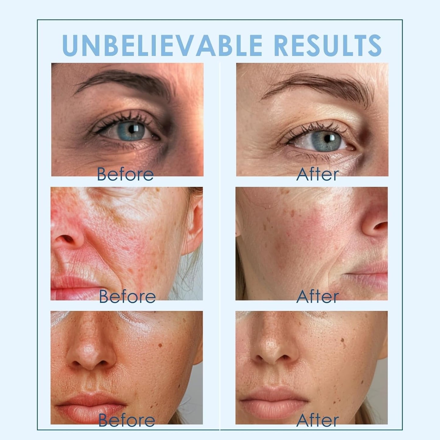 Facial Ice Globes Cryo Sticks, Cooling Beauty Tool for Face, Neck & Eyes, Helps Reduce Puffiness, Refine Pores & Smooth Fine Lines, Cryotherapy Roller for At-Home Skincare Routine