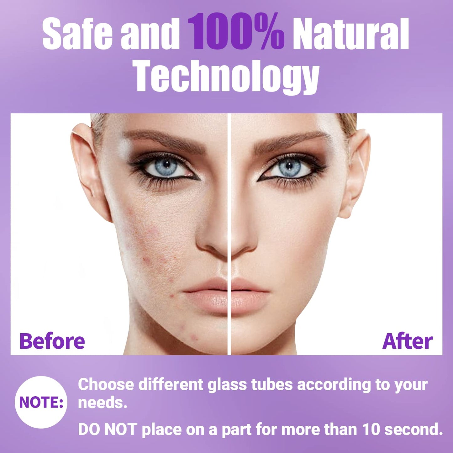 High Frequency Facial Wand-UUPAS Portable Handheld High Frequency Facial Machine Skin Facial Wand with 4 Violet Tubes
