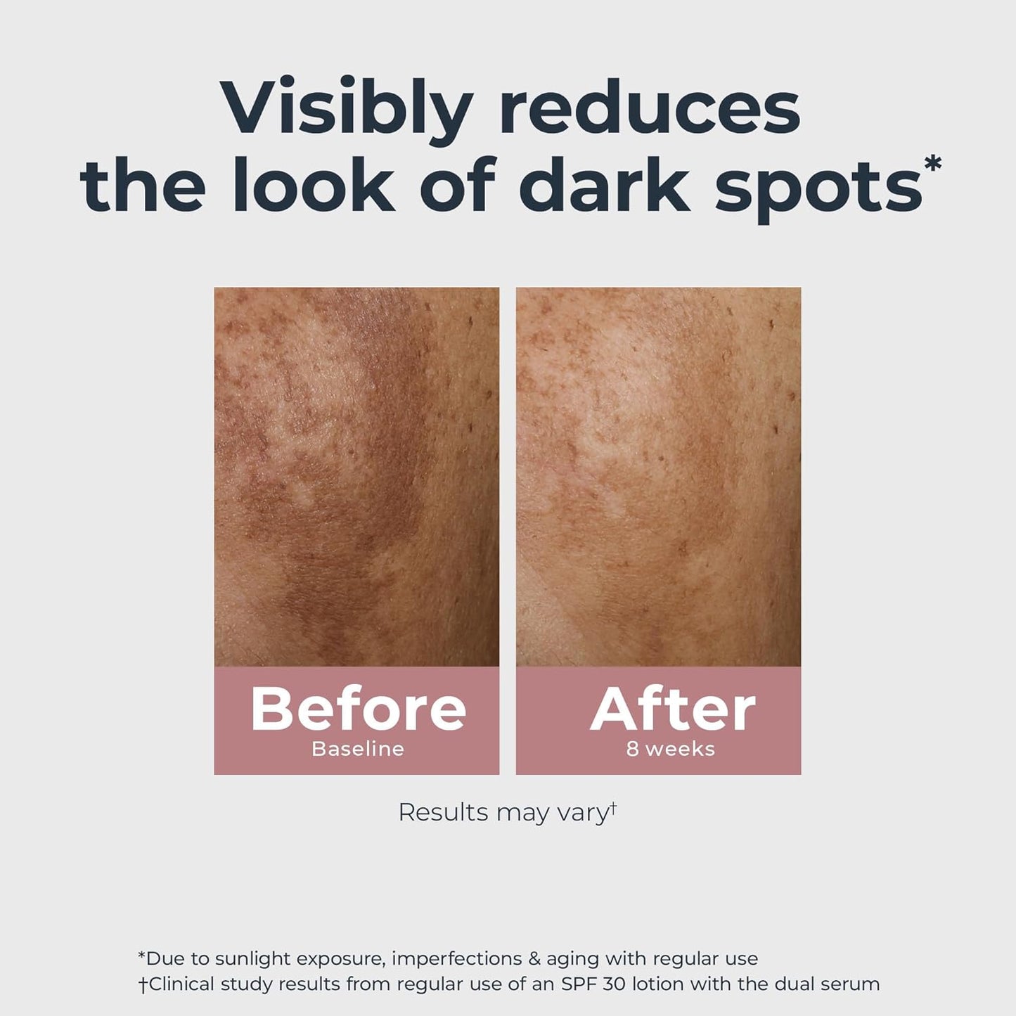 Eucerin Radiant Tone Dual Serum Dark Spot Corrector, Dark Spot Serum with Thiamidol and Hyaluronic Acid, Helps Visibly Reduce the Look of Persistent Dark Spots, 1 Fl Oz Bottle