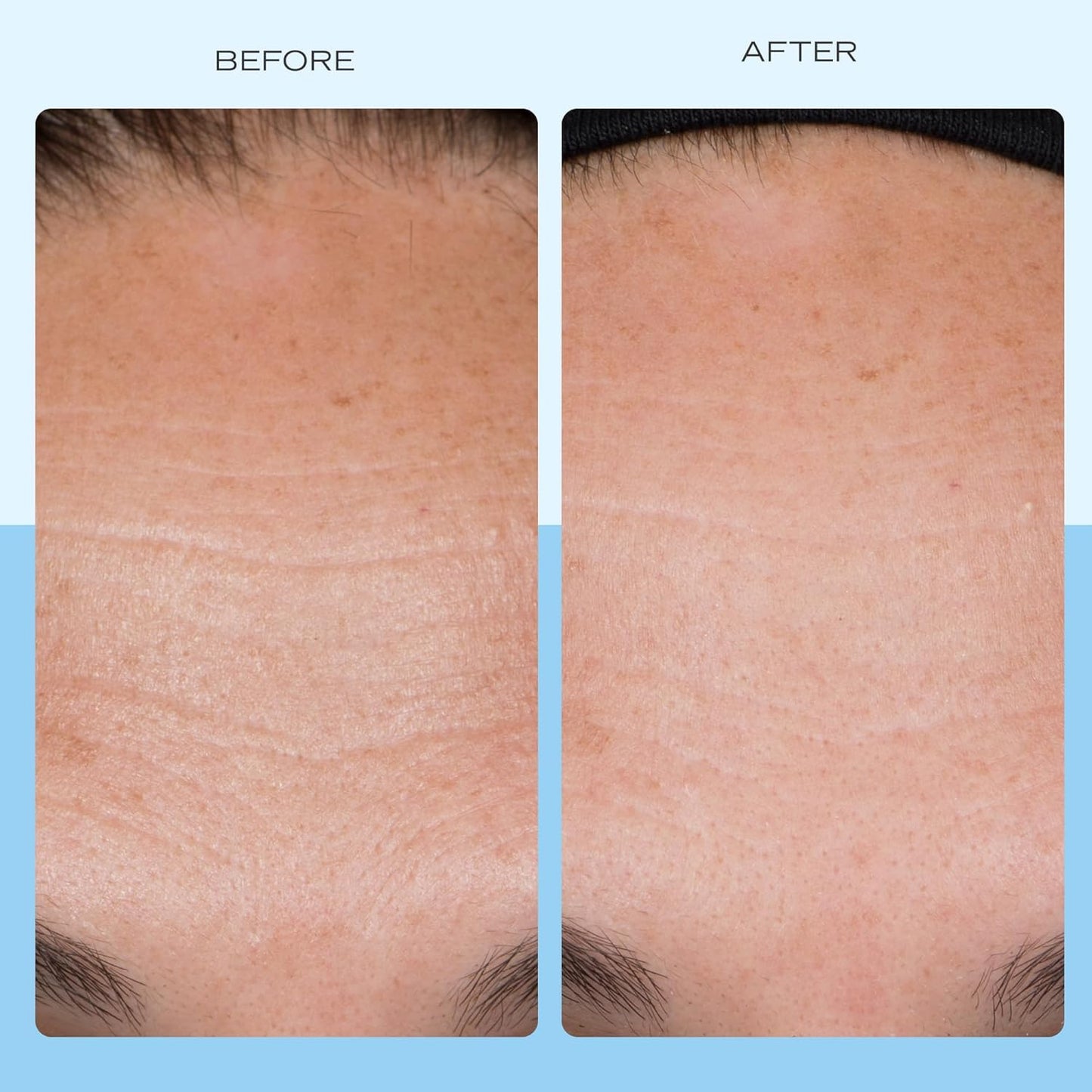 First Aid Beauty Firming Collagen Cream with Collagen, Peptides and Niacinamide – Day + Night Anti-Aging Face Moisturizer – 1.7 fl oz