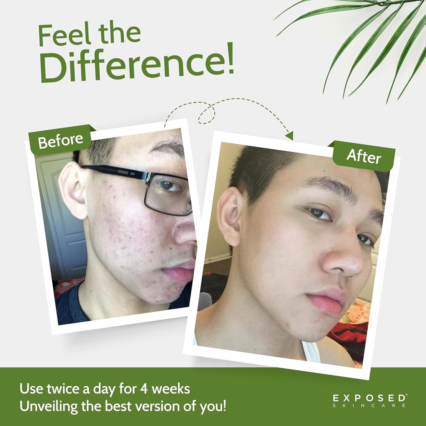 Exposed Skin Care Activated Charcoal Face Mask to Purify Skin, Regulate Oil Production and Visibly Minimize Pores – Clarifying Acne Treatment Mask with Bentonite and Sulfur (1.7 Fl. Oz.)